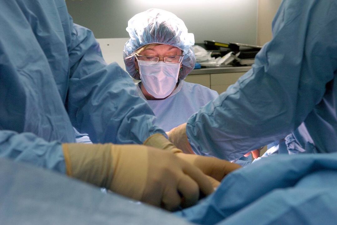 Penis lengthening surgery